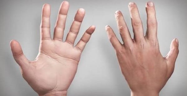 10 Interesting Facts About Human Skin